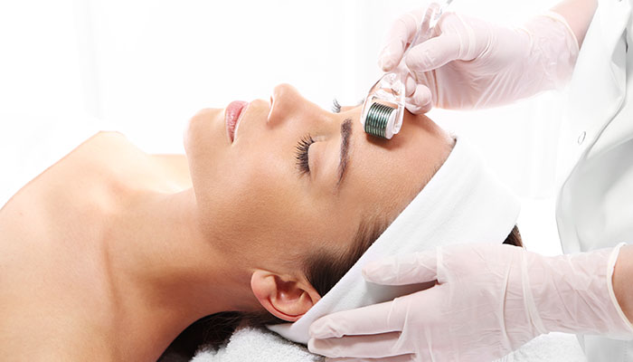 Microneedling